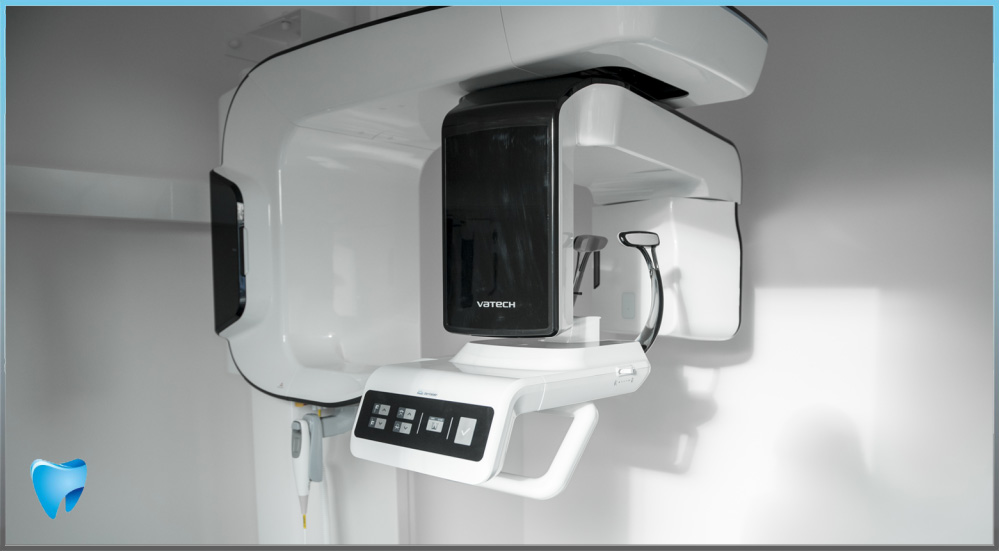 3D scan gebit Maxim Clinic Verwijspraktijk