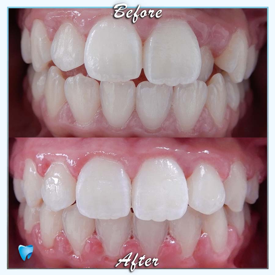 Orthodontie Rotterdam